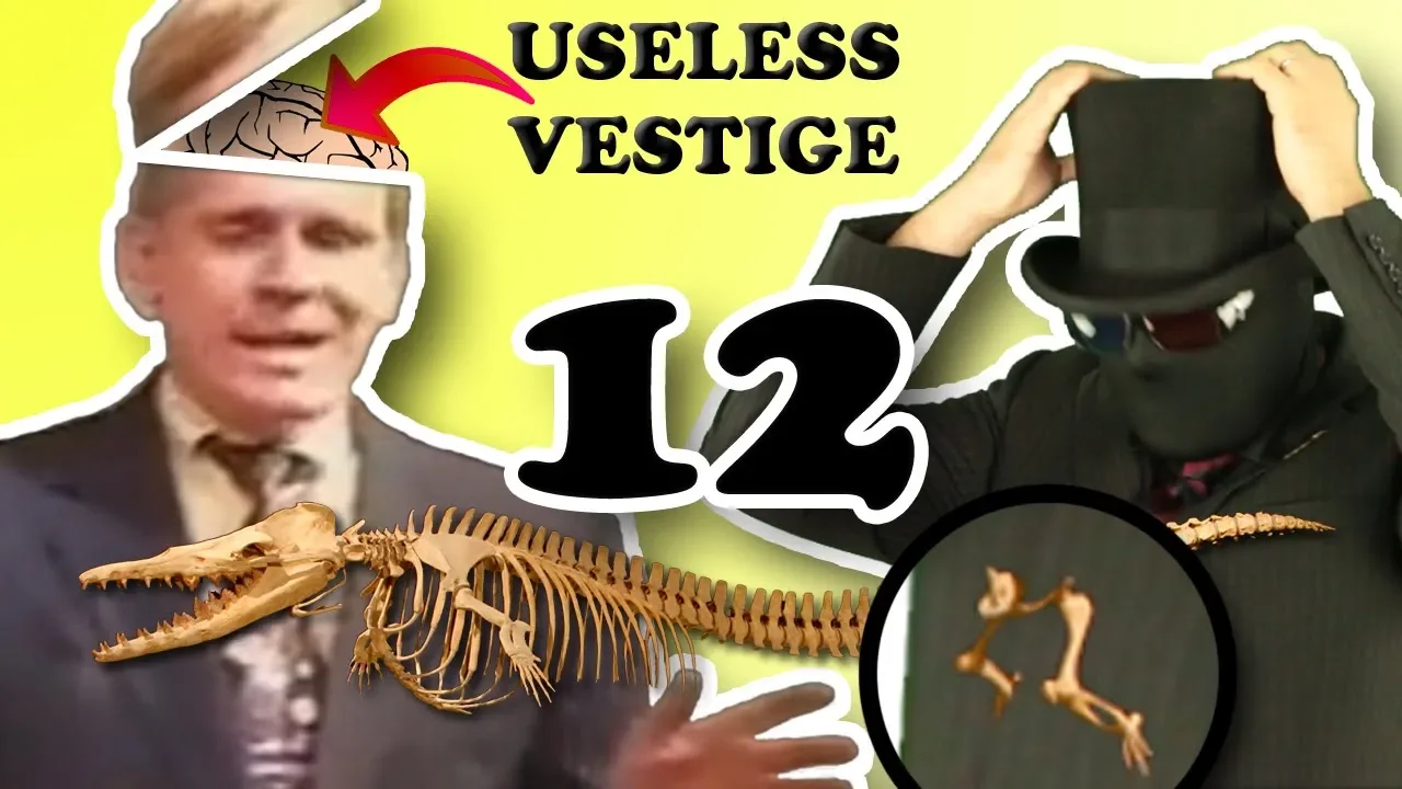 Hello, My Name is Kent Hovind 12: Kent’s Vestigial Brain
