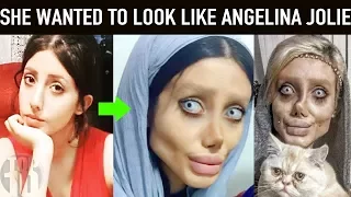 people who took plastic surgery too far