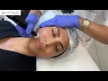 Pure Serenity Skincare Collagen Induction Therapy CIT