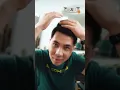 Download Lagu SULAP RAMBUT BOTAK JADI TUMBUH LEBAT!!! SOLUSI AMPUH ATASI KEBOTAKAN!!!