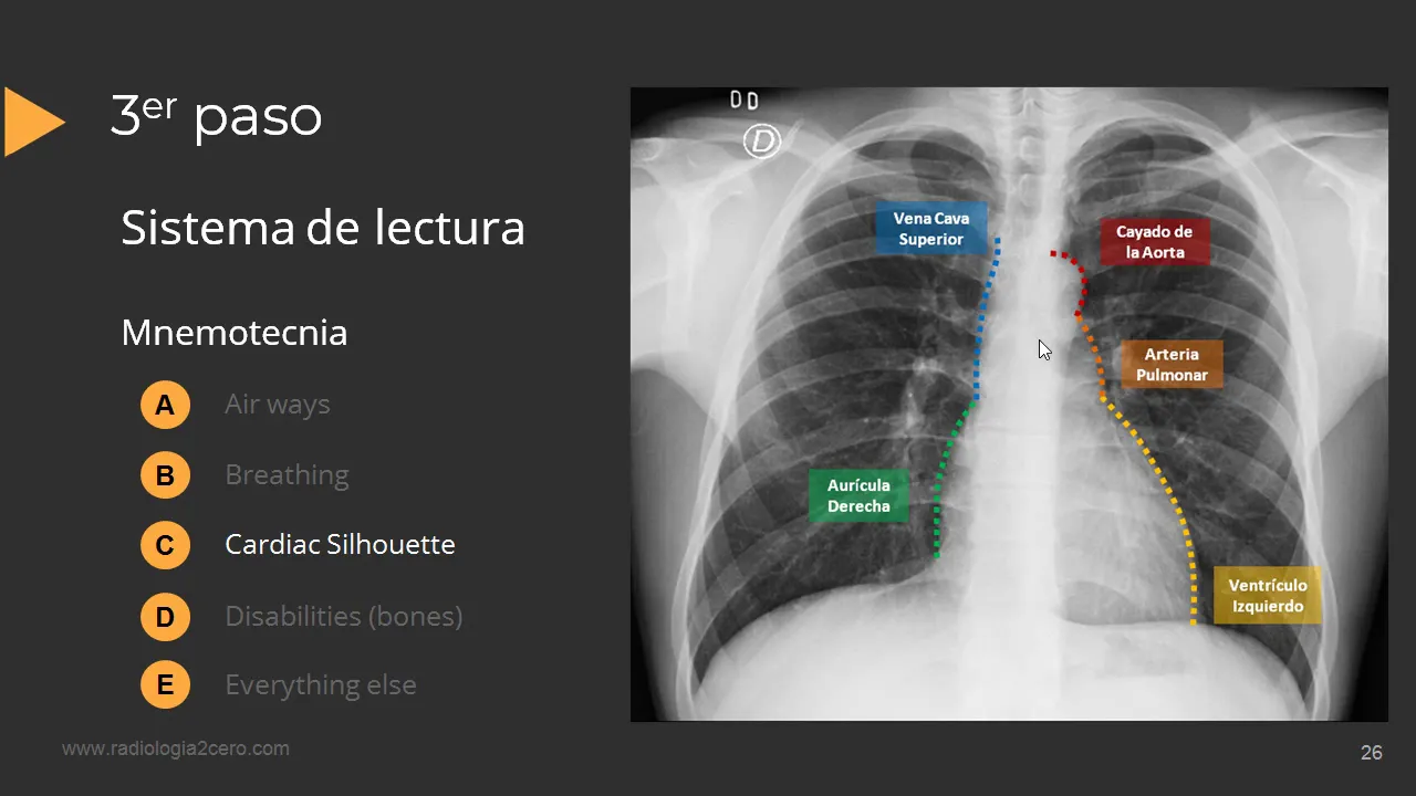Guia para interpretar una Radiografía de Tórax