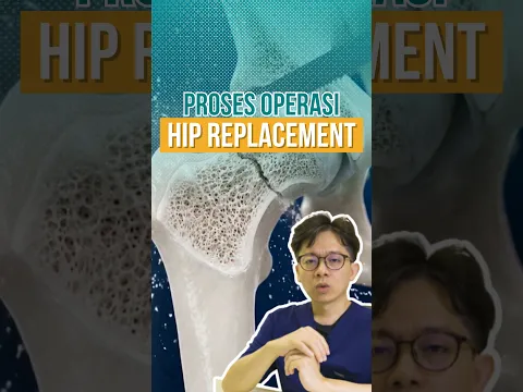 PROSES OPERASI HIP REPLACEMENT