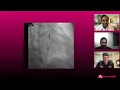 Download Lagu Dr. Sibi Thomas details his approach to the nasty ostial calcified LCX #cardiology #shockwave