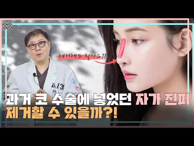 코에 넣은 자가 진피, 마음에 안 들면 무조건 봐야 할 영상!! 자가 진피 제거 심층 분석!! 자가 진피 1편_[4월31일 성형외과]