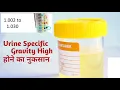 urine specific gravity urine specific gravity test