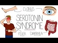 Lagu Serotonin Syndrome Explained (Serotonin Toxicity)