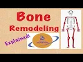 Bone REMODELING FORMATION RESORPTION RANK OSTEOPROTEGRIN explained simply USMLE COMLEX NCLEX