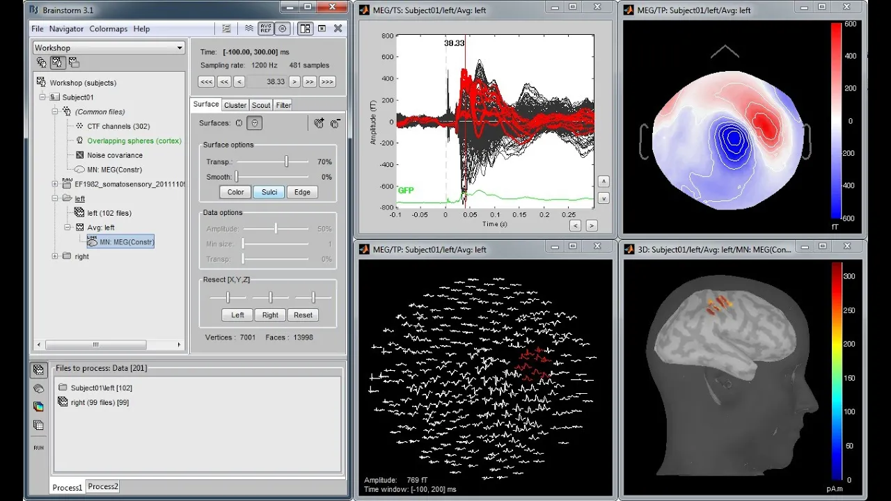 Brainstorm: Imaging neural activity at the speed of brain