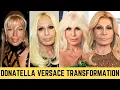Donatella Versace - NEW DRAMATIC FACE CHANGE 2024