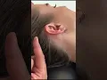 How to do Trigger Point Therapy on the Sub Occipital Muscles