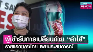 ทำไมผู้ป่วยต้องรอการปลูกอวัยวะถึง 3 ปี