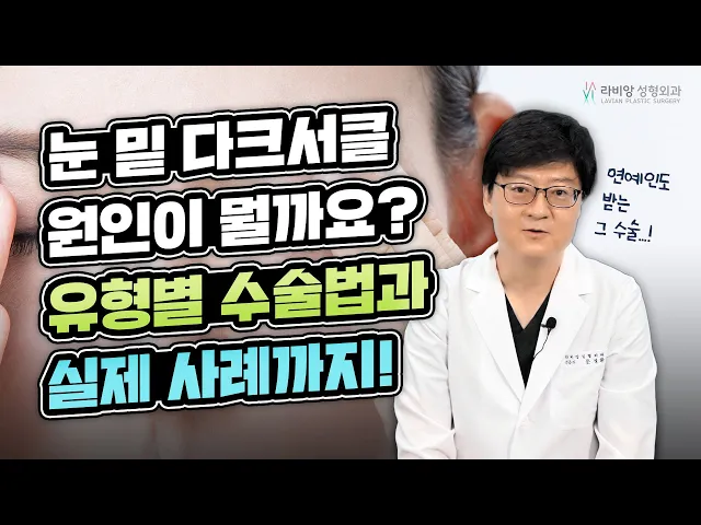 다크써클 원인과 없애는 방법을 알아볼까요!!??😎😎😎