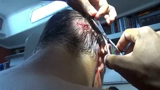 Head Injury at sea!— Sailing Uma [Step 117]