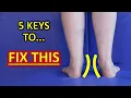 The 5 KEYS To Improve Flat Feet Fallen Arches Foot Overpronation