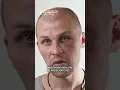 Download Lagu How do you treat a black eye? | Health Tips | YouTube Shorts