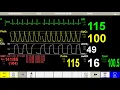 Download Lagu MH Vitals