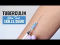 Tuberculin Skin Test PPD Skill Demo Step-by-Step for Nurses Nursing Students