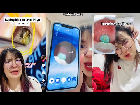 FANEN UBI PAKE KOREK KUPING YANG ADA KAMERANYA? NAJONG JIJAY BAGONG??