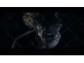 Download Lagu TERESA - Torn (Official Music Video)