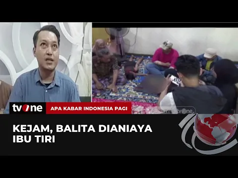 Sadis! Ibu Tiri di Palopo Aniaya Bayi 2 Tahun hingga Tulang Tangan Retak
