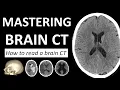 Mastering Brain CT How to read a brain CT like a pro