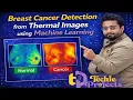 Breast Cancer Detection using Machine Learning Breast Cancer Classification using CNN