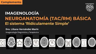 Neuroanatomía seccional básica (TAC y RM) - El sistema "ridículamente simple"