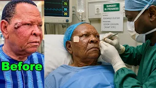 Adewale Elesho Successfully Undergoes Surgery After Fans Raised Concerns Over His Health