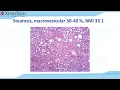 Biobank Fatty Liver Disease Tissues and Their Exploration in Microarrays