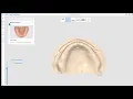 Download Lagu Full Denture Scan (ENG)