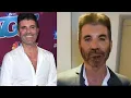 New Sparks Concerns Over Simon Cowell s Appearance