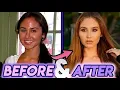 Catherine Paiz Before and After Transformations Plastic Surgery Transformation