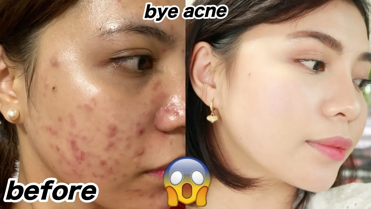 PM Skincare Routine • Oily, Acne Prone Skin • Thoughts on Skincare. 