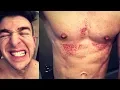 CHEMICAL BURNED WITH NAIR Watch This Before Using Nair For Hair Removal