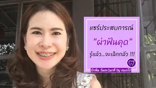 การผ่าฟันคุดมีขั้นตอนหลักๆ อะไรบ้าง และแต่ละขั้นตอนเกี่ยวข้องกับอะไร