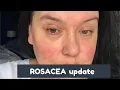 Download Lagu ROSACEA UPDATE (ad/not paid/pr/bought/affiliated links/trackable links)