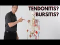 What is Causing Your Shoulder Pain Tendonitis Bursitis How to Know