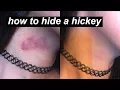HOW TO HIDE A HICKEY