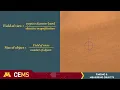 Using a Light Microscope Finding and Measuring Objects