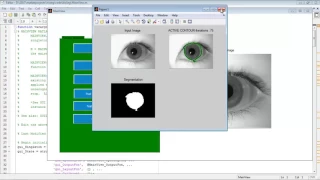 Iris segmentation matlab code projects