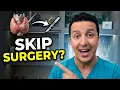 Benign Thyroid Nodule You May NOT Need Surgery Ask About RFA