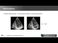 Download Lagu Demo ECHOpen by Yingyu YANG, PhD student at Epione, inria.