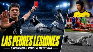 Las LESIONES más BRUTALES de la historia del FÚTBOL