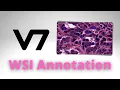 WSI Annotation for Machine Learning V7 Tutorial