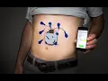 Electrogastrography CPT code - simplify medical coding