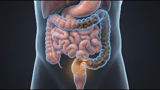 Constipation: How Stool Becomes Hard and Difficult to Pass