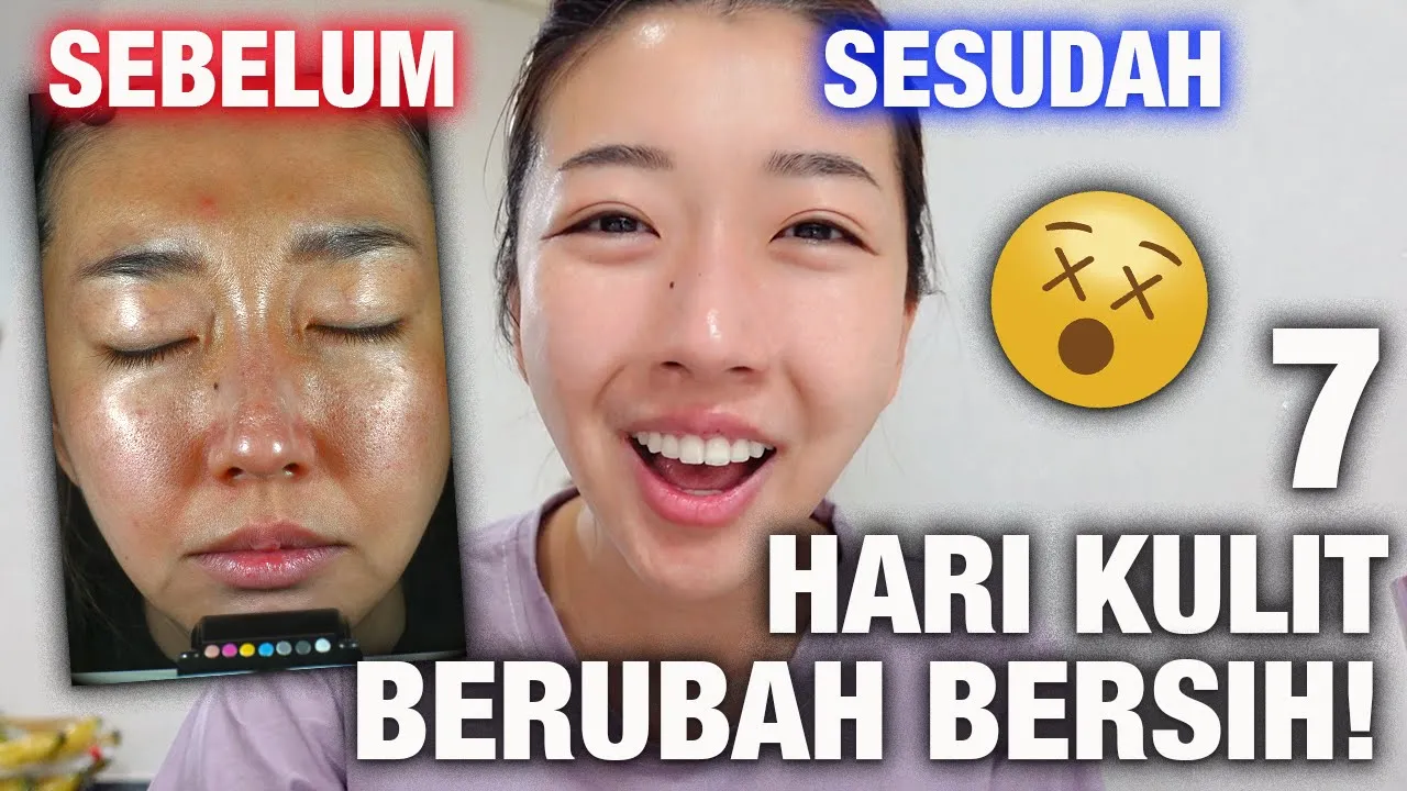3 BASIC SKIN CARE ROUTINE COWO BIAR GAK DEKIL. 