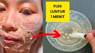 CUKUP 2 BAHAN 3 HARI SAJA !! FLEK SEMBUH TUNTAS SEMUANYA!!