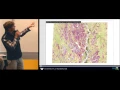 Spatial Patterns of Canopy Structure - UW GIS Day 2015