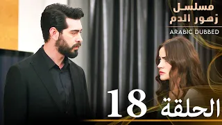 الحلقة 18 مسلسل زهور الدم مدبلج بالعربية Kan Çiçekleri 
